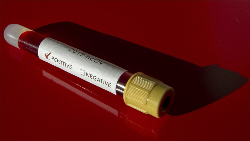 RS - 42 novozaraženih koronavirusom, preminulo 13 osoba